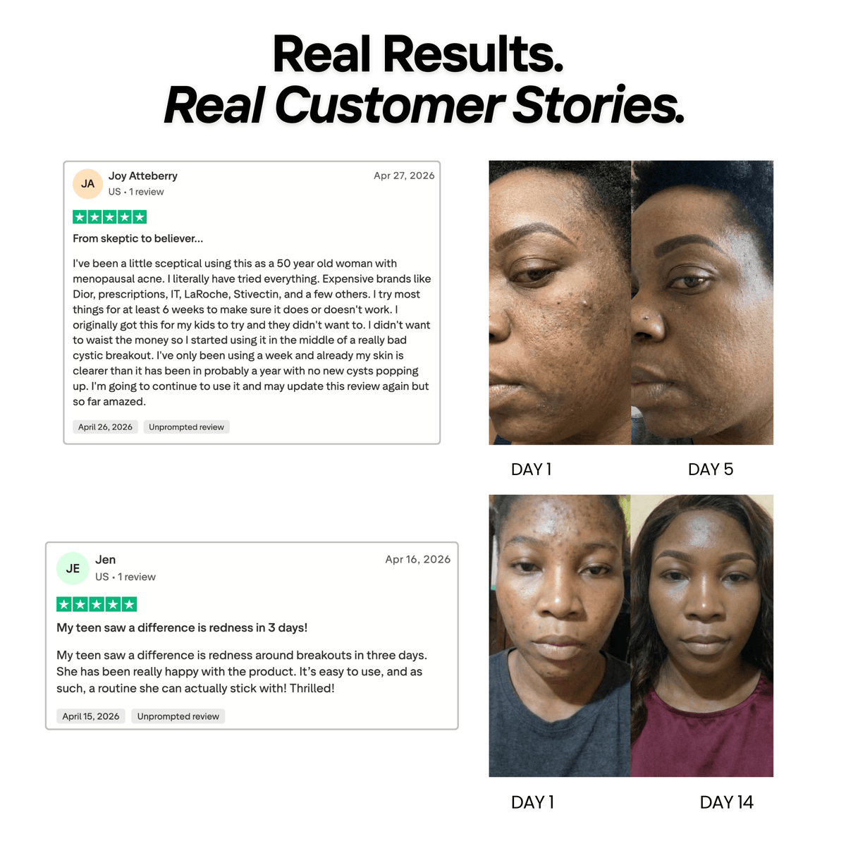 The Acne & Redness Reset Powder - TRY SIDR®